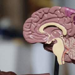 Anatomical brain model
